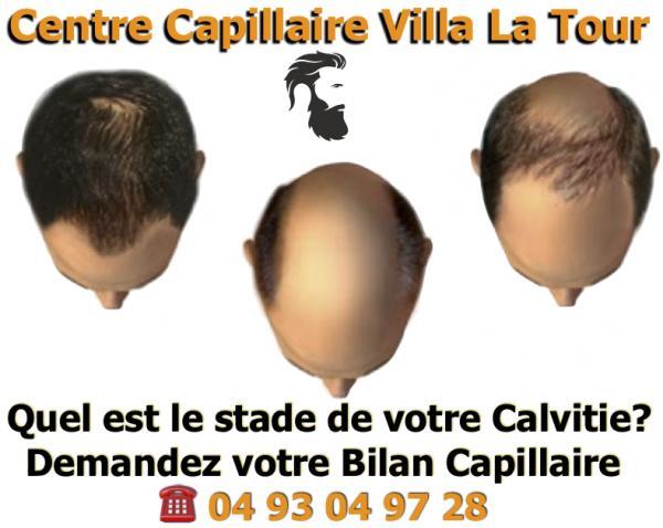 perte définitive cheveux - bilan capillaire offert