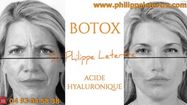 botox acide hyaluronique quelle différence